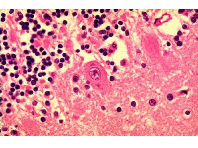 Anne Arundel Co. Health Dept. warns of rabid fox